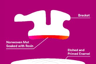 3M™ APC™ Flash-Free Adhesive