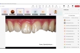 Prof.Dr.Hande Şar Sancaklı İle Kompozit Lamina İle İdeal Estetik İçin Klinik İpuçları Online Eğitim